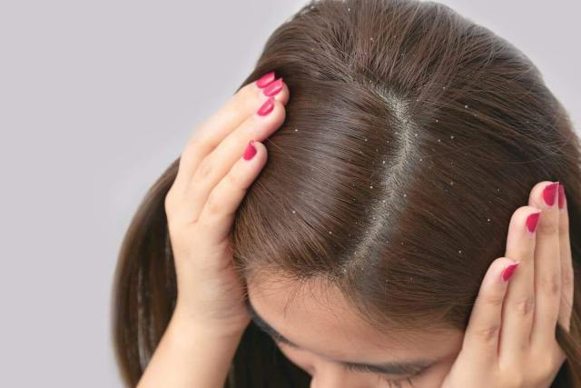 If you struggle with dandruff, Klorane has an innovative & natural anti-dandruff solution
