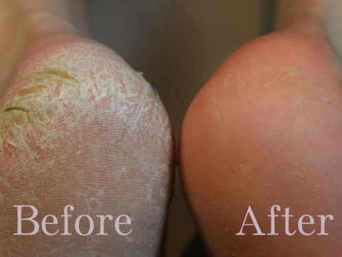 Sole Spa Retreat