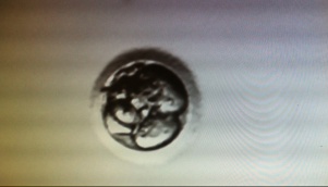 Why I cant let our extra frozen embryos perish