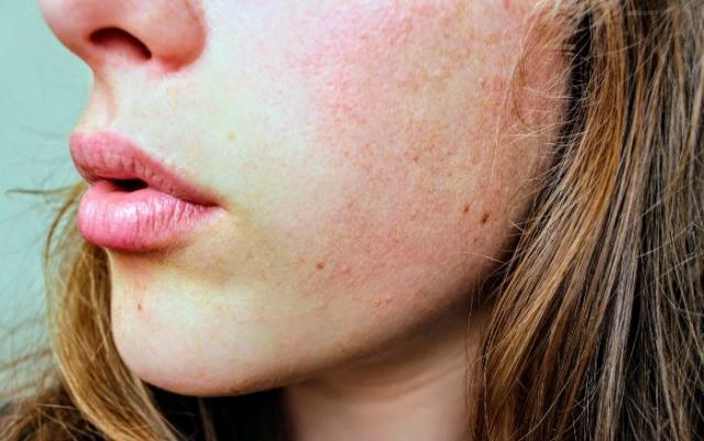 This affordable face-cream is perfect for the summer time