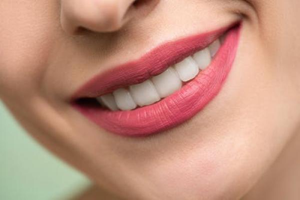 Get those pearly whites out with Polished Londons cult favourite products!