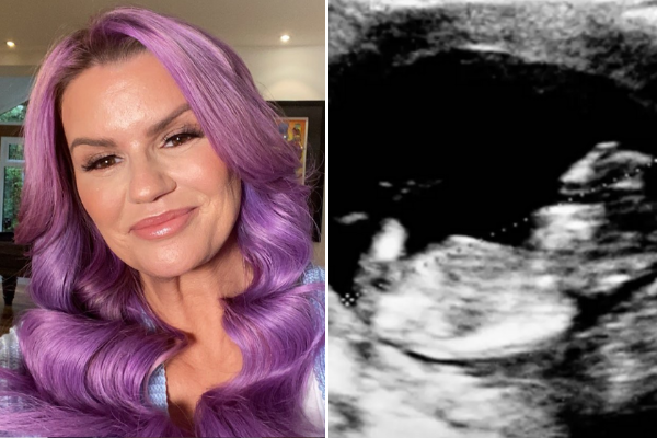 Kerry Katona faces major backlash over April Fool’s Day pregnancy prank